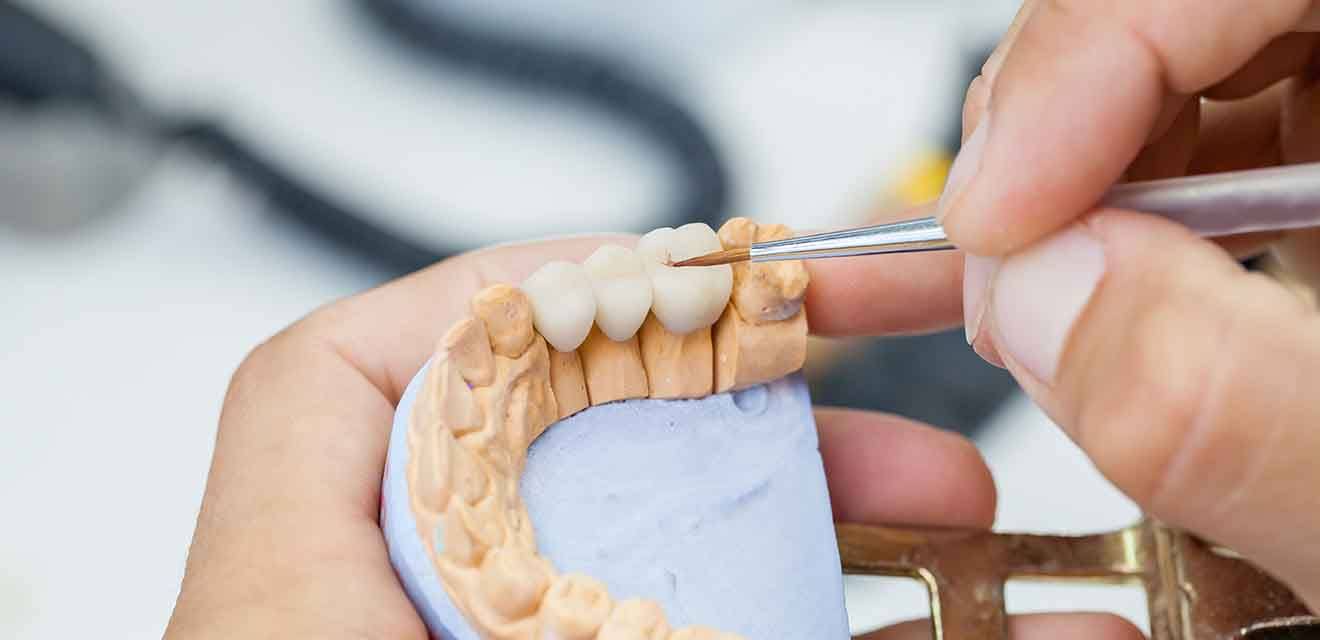 Dental bridge being milled