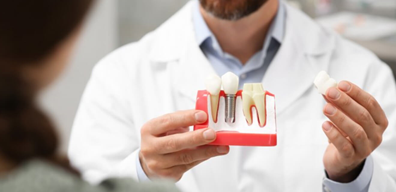 a dentist holding a model of dental implants